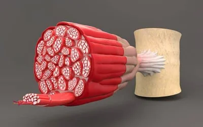 Hipertrofia
